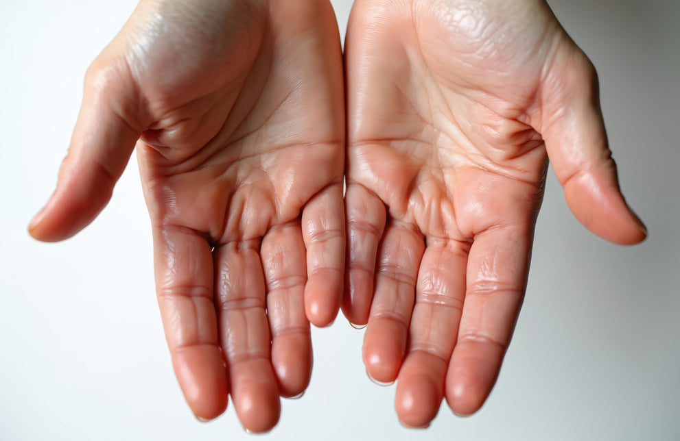 Excessive Sweating: Causes, Types, and Best Treatments by Body Area