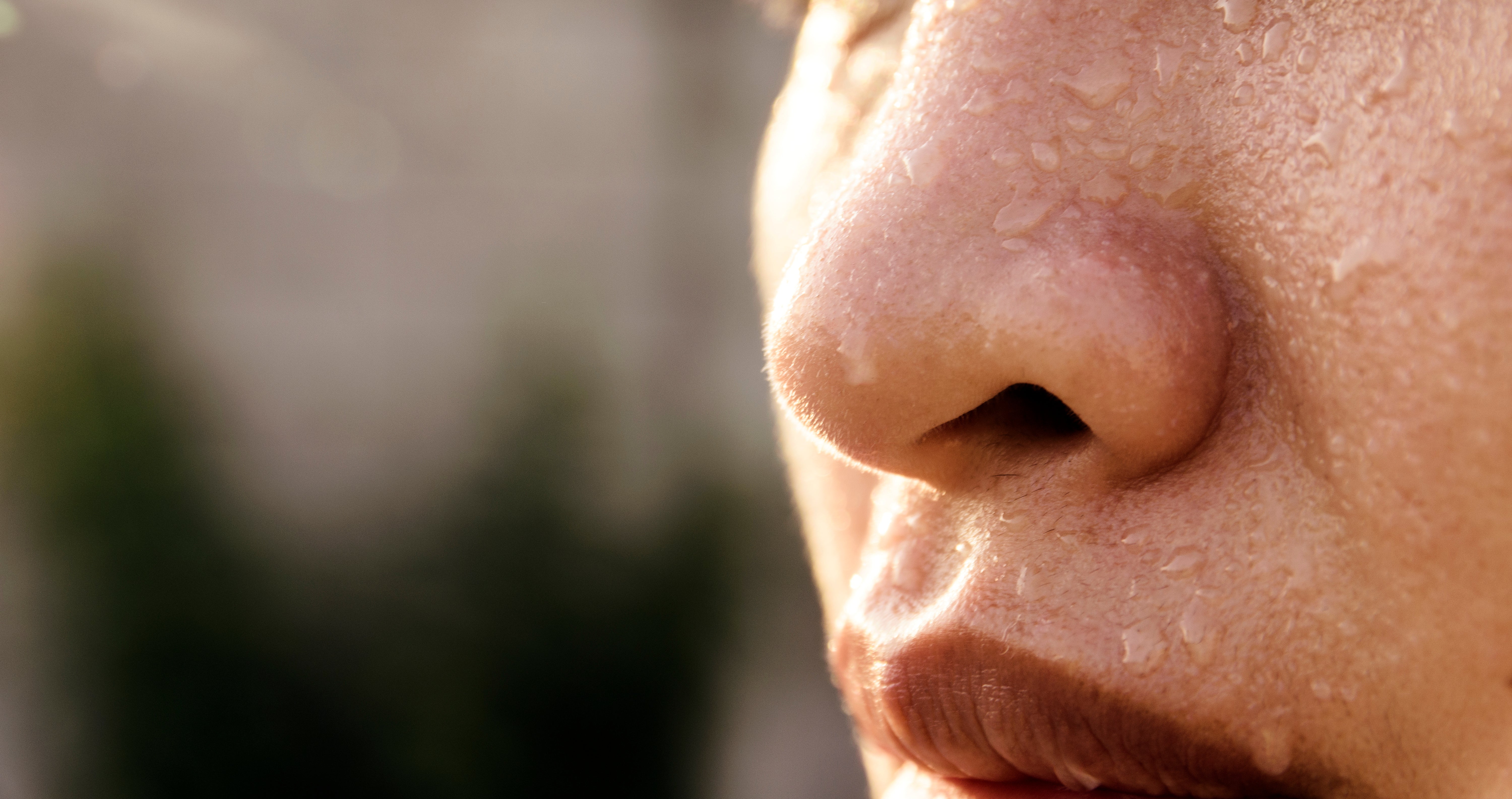 Facial Sweating Treatment (Craniofacial Hyperhidrosis) – Undefined Health