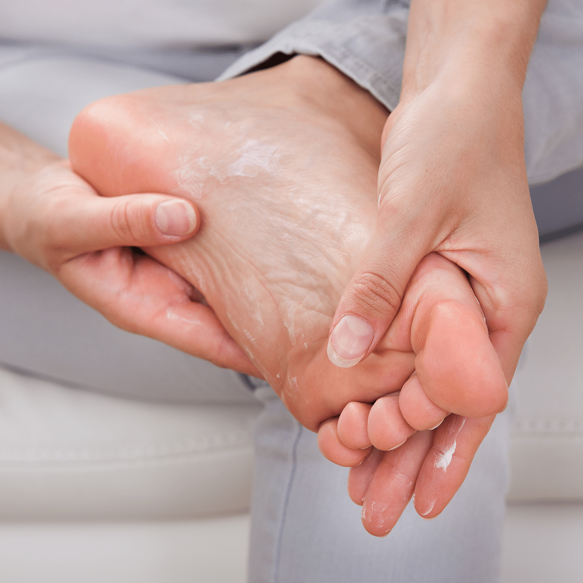 Person applying prescription strength antiperspirant to their feet to treat plantar hyperhidrosis